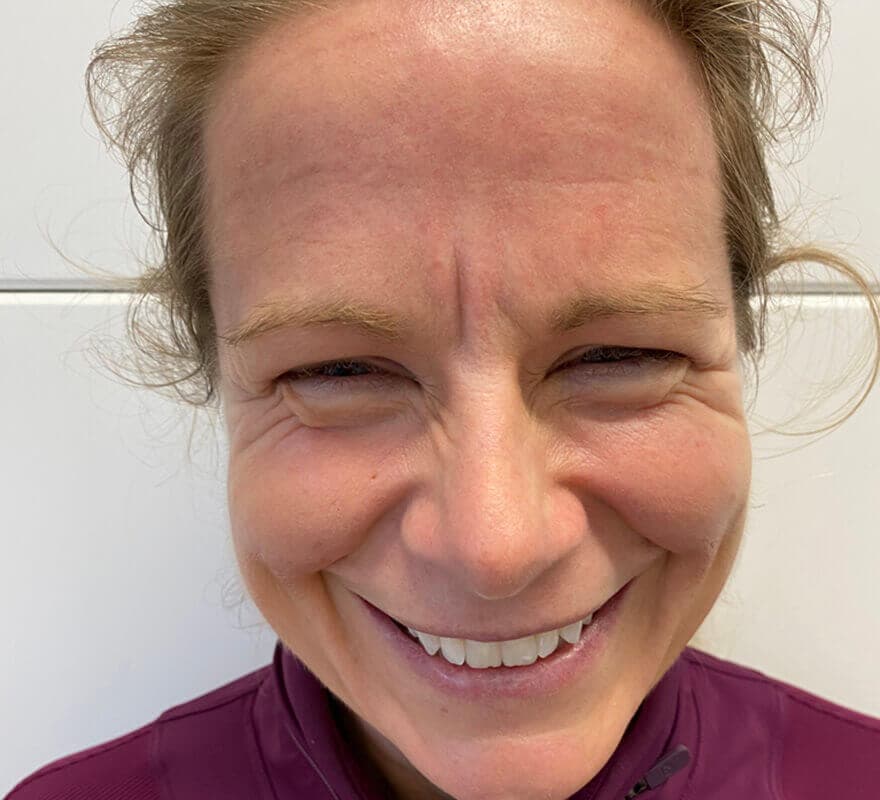 face-brows-before