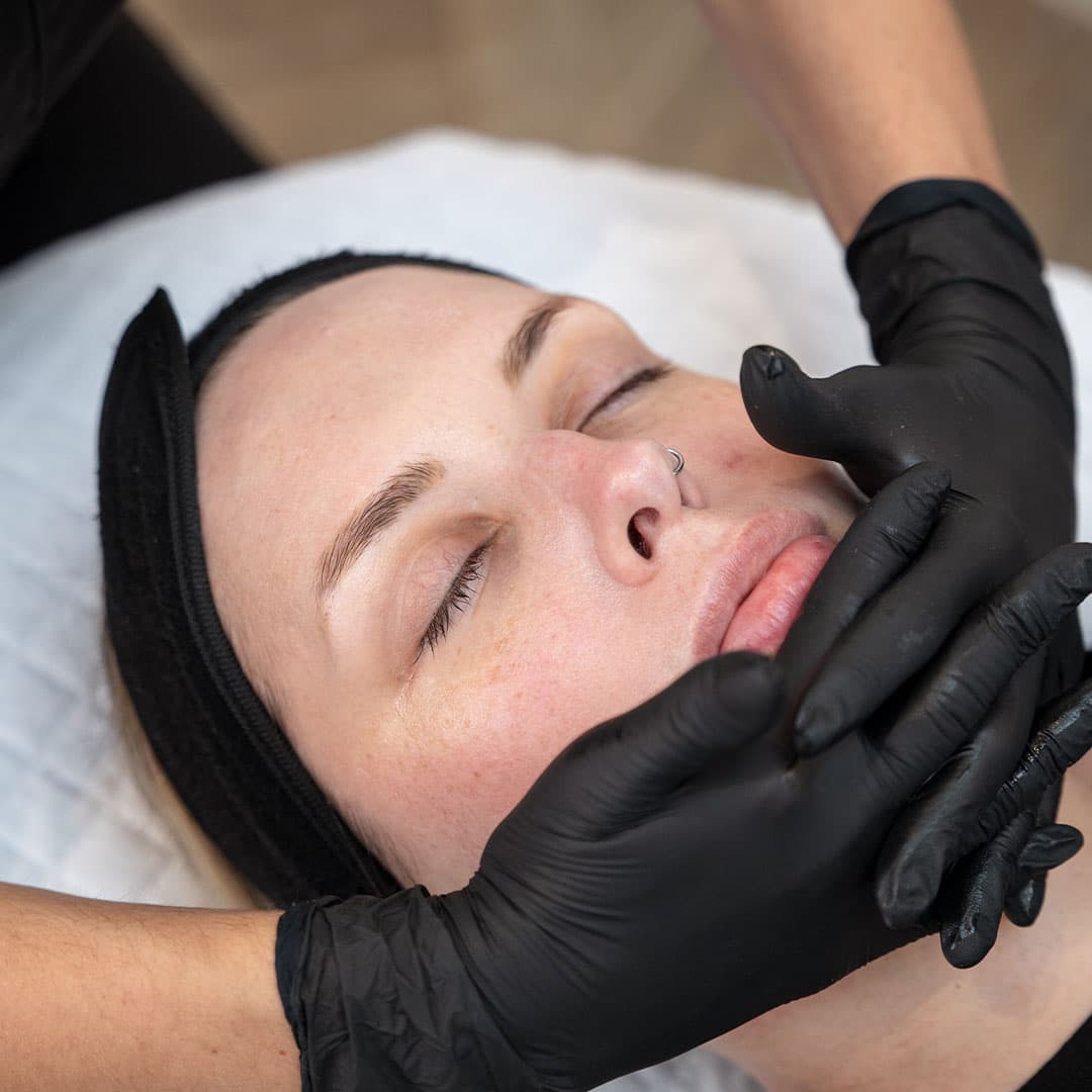 Skin-treatment