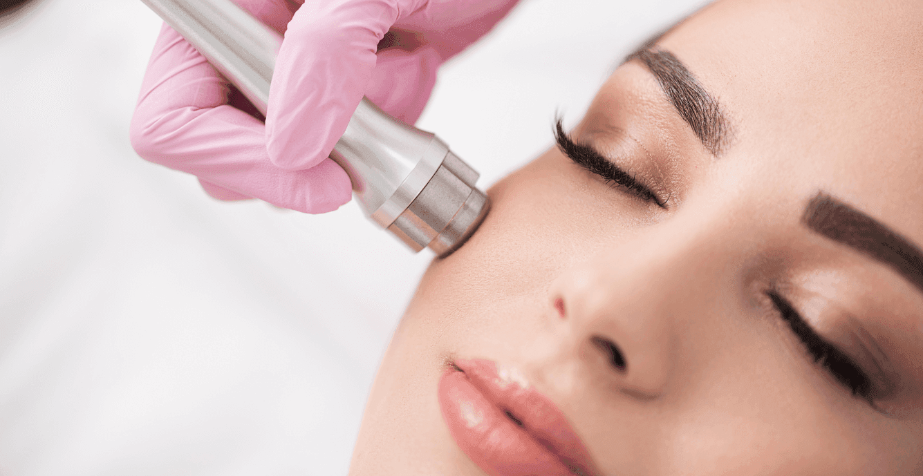 micro-needling-cheek