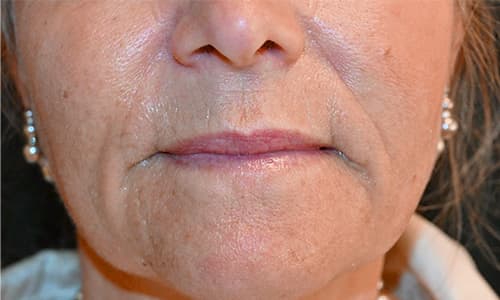 julaine-before-after-1