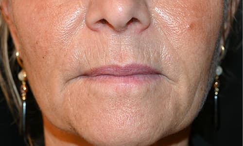 julaine-before-after-1